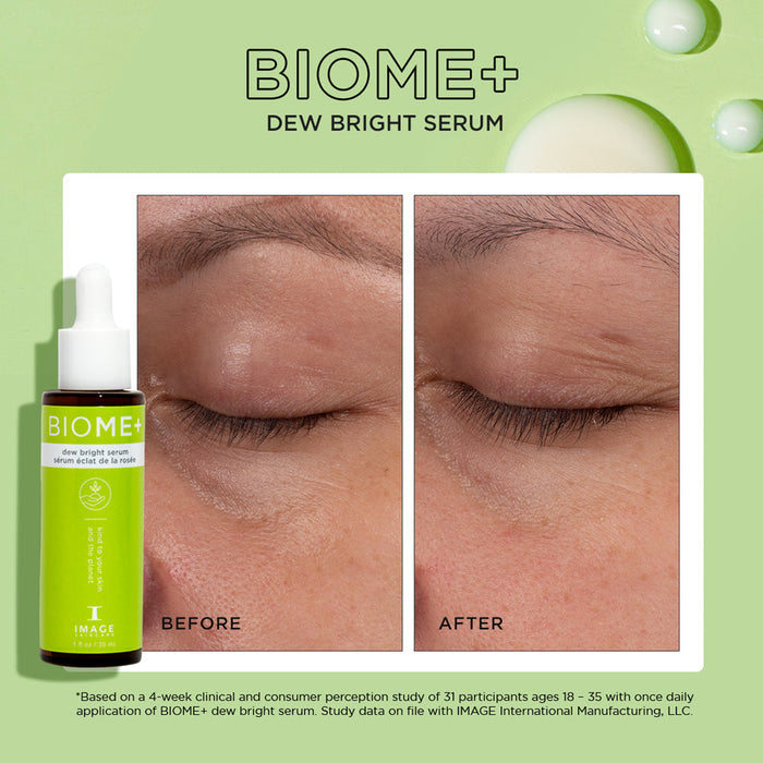 Before and after close-up images of a person's eye area showing improved brightness and reduced dark circles using BIOME+ dew bright serum | IMAGE Skincare, displayed alongside the product bottle.